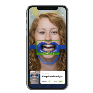 Grin Virtual Monitoring technology in use at Behl Orthodontics for remote orthodontic care.